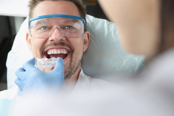 Why Bite Alignment Matters Even For Simple Whitening Requests