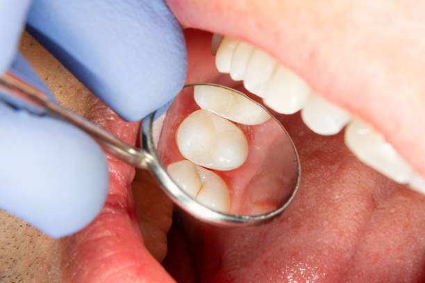 The Role Of Preventive Dentistry In Supporting Stronger Gums