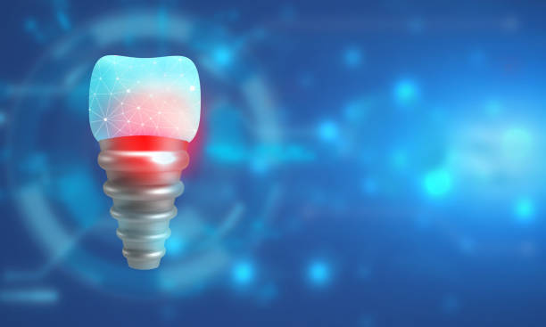 4 Innovations Making Implants More Cosmetic Than Ever