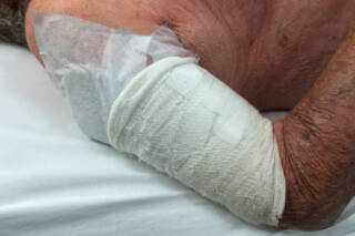 Understanding Personal Injury Claims in Brisbane: A Simple Guide